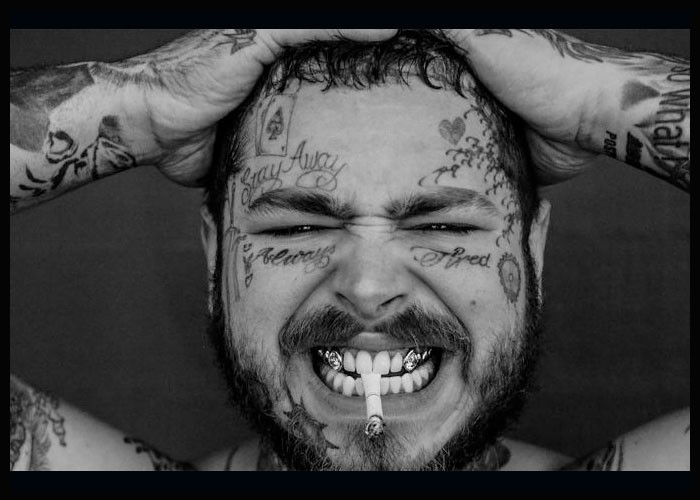 Post Malone Spends $1.6 Million On New Smile With Diamond Fangs